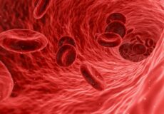 anemia header