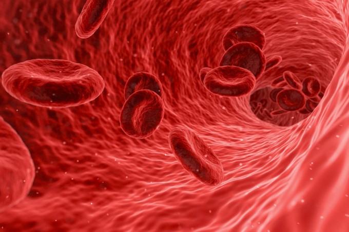 تاثیر مورینگا اولیفرا بر کم خونی 1 anemia header