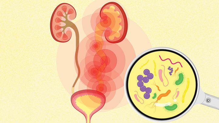 تاثیر مورینگا اولیفرا بر عفونت های دستگاه ادراری 1 urinary tract infection guide 722x406 1